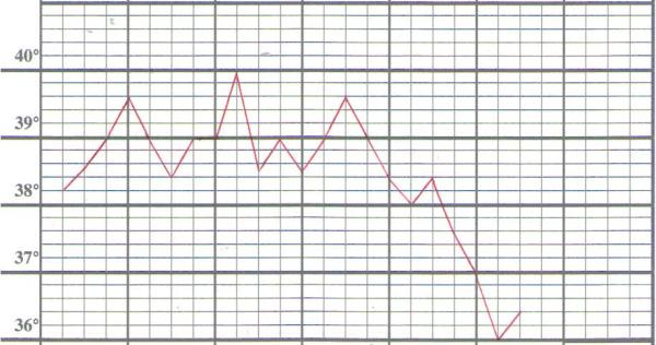 Andamento della temperatura durante una delle crisi febbrili